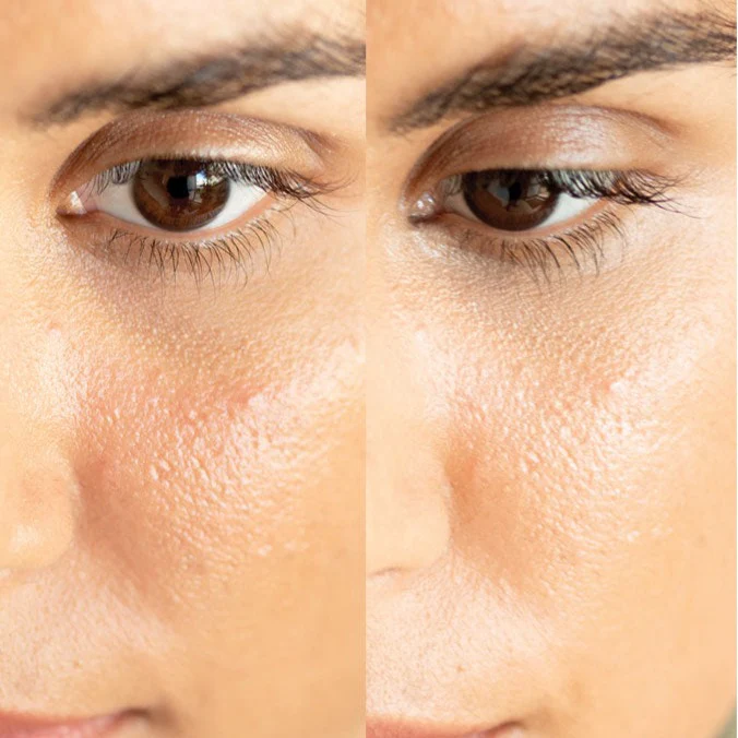Ere Perez Lychee Crème Corrector - Image 19