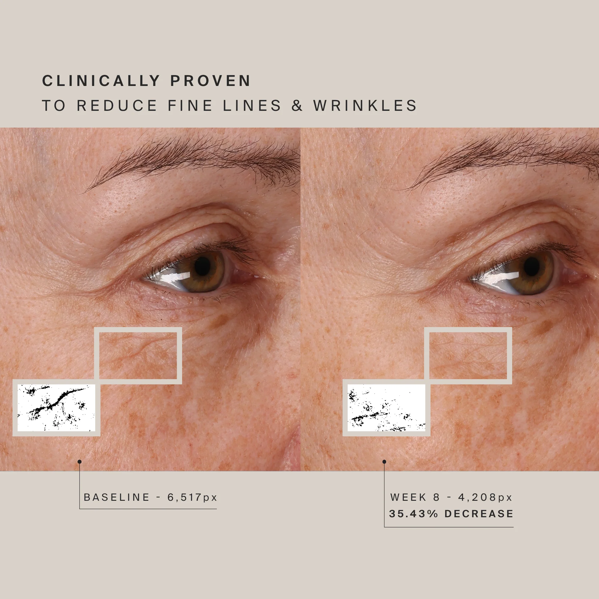 HigherDOSE Red Light Face Mask - Image 6