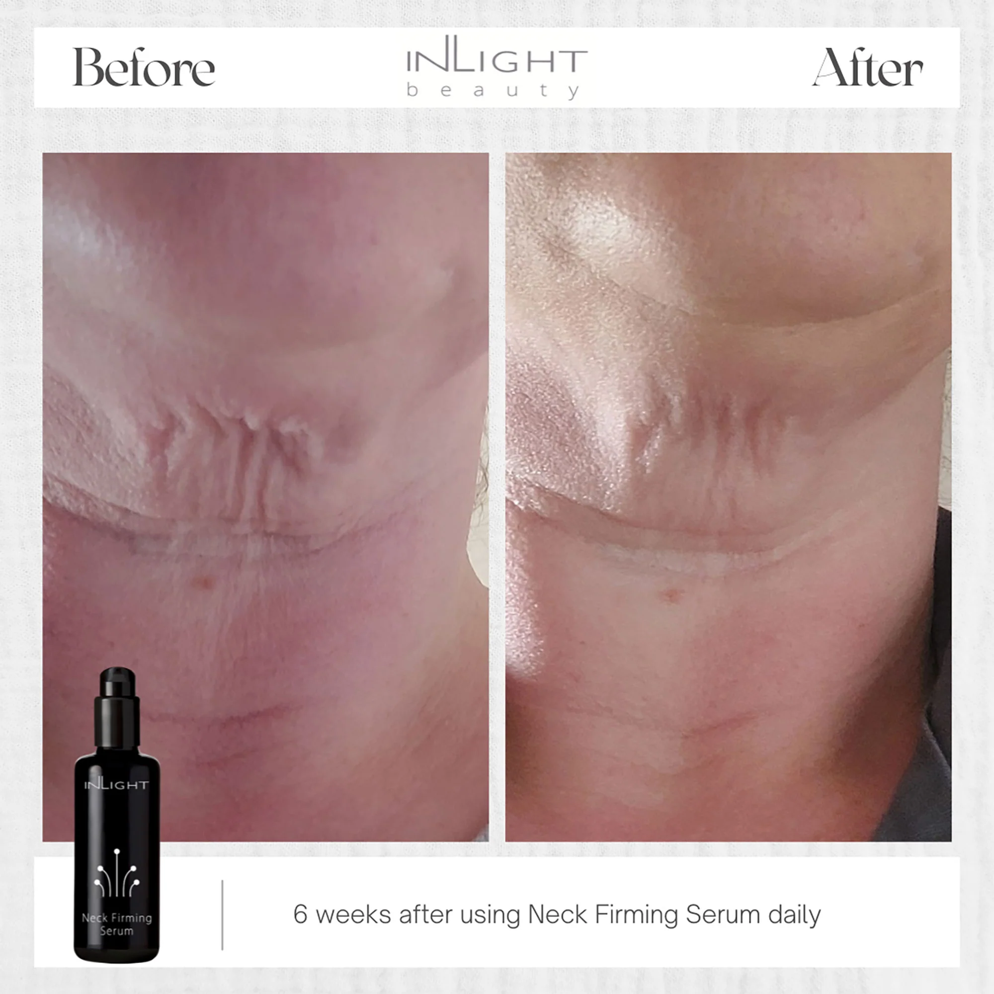 Inlight Neck Firming Serum - Image 4