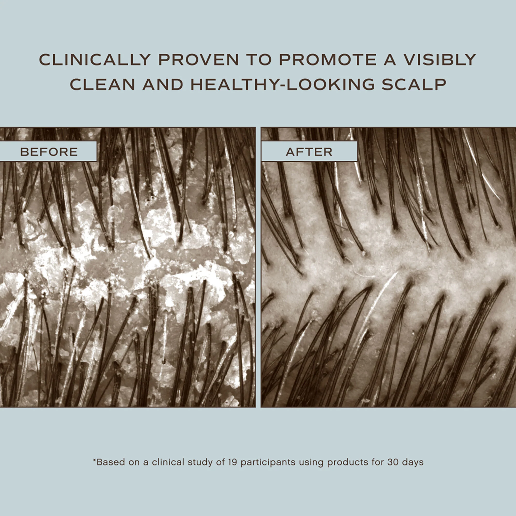 Innersense Hair Renew Scalp Hairbath - Image 4