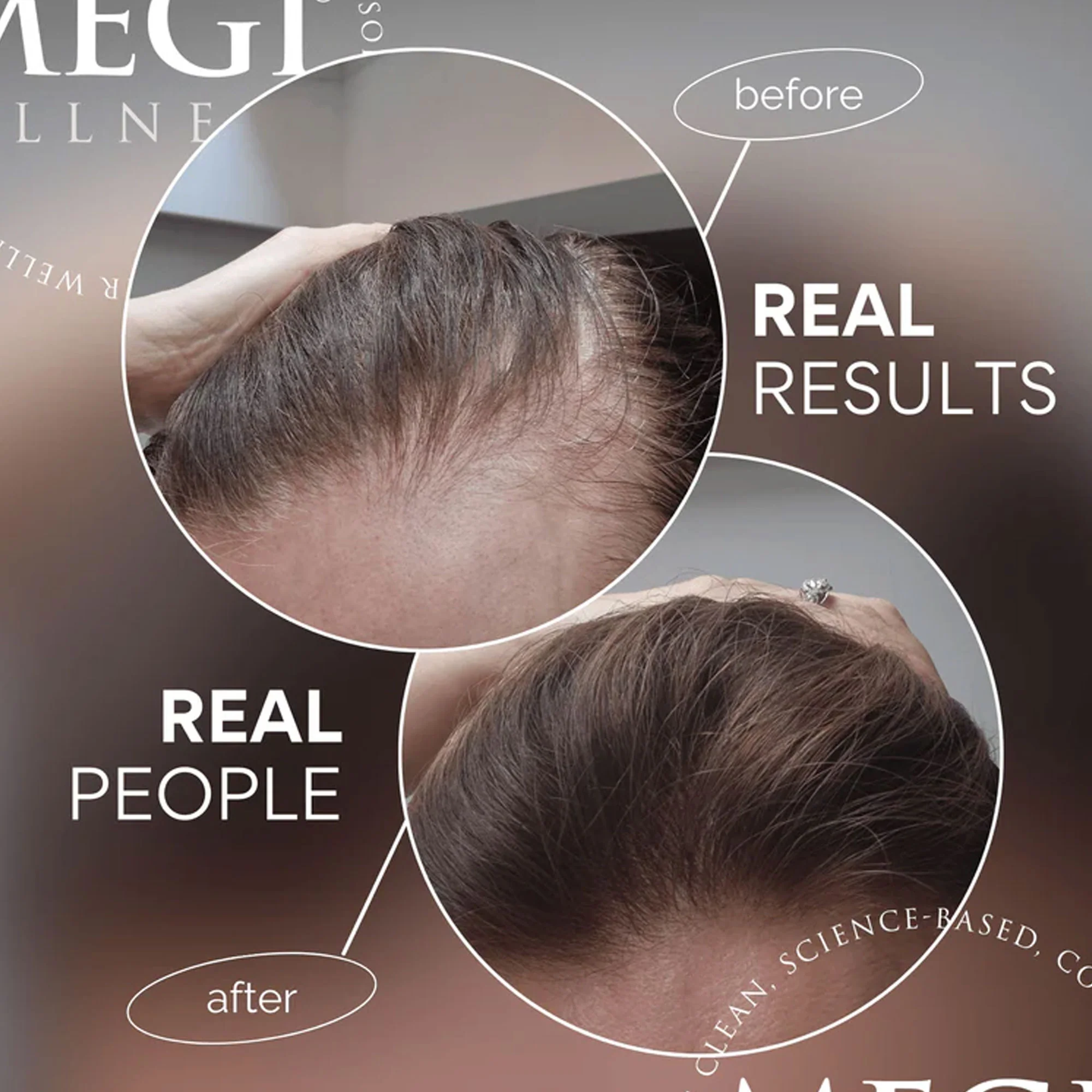 Megi Wellness Growth Stimulating Set (Worth £86.67) - Image 5