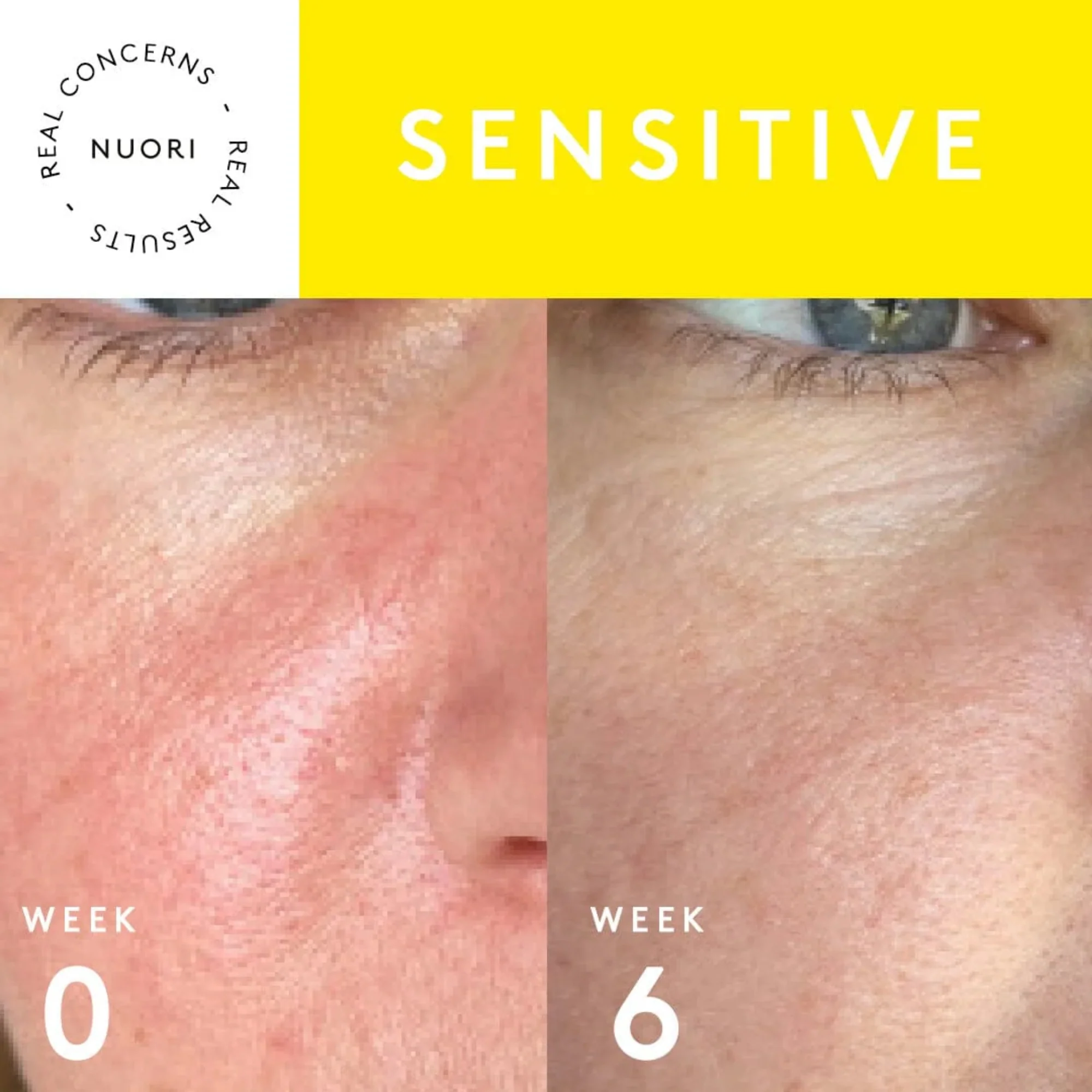 NuorI Vital Repair Serum - Fragrance Free - Image 4