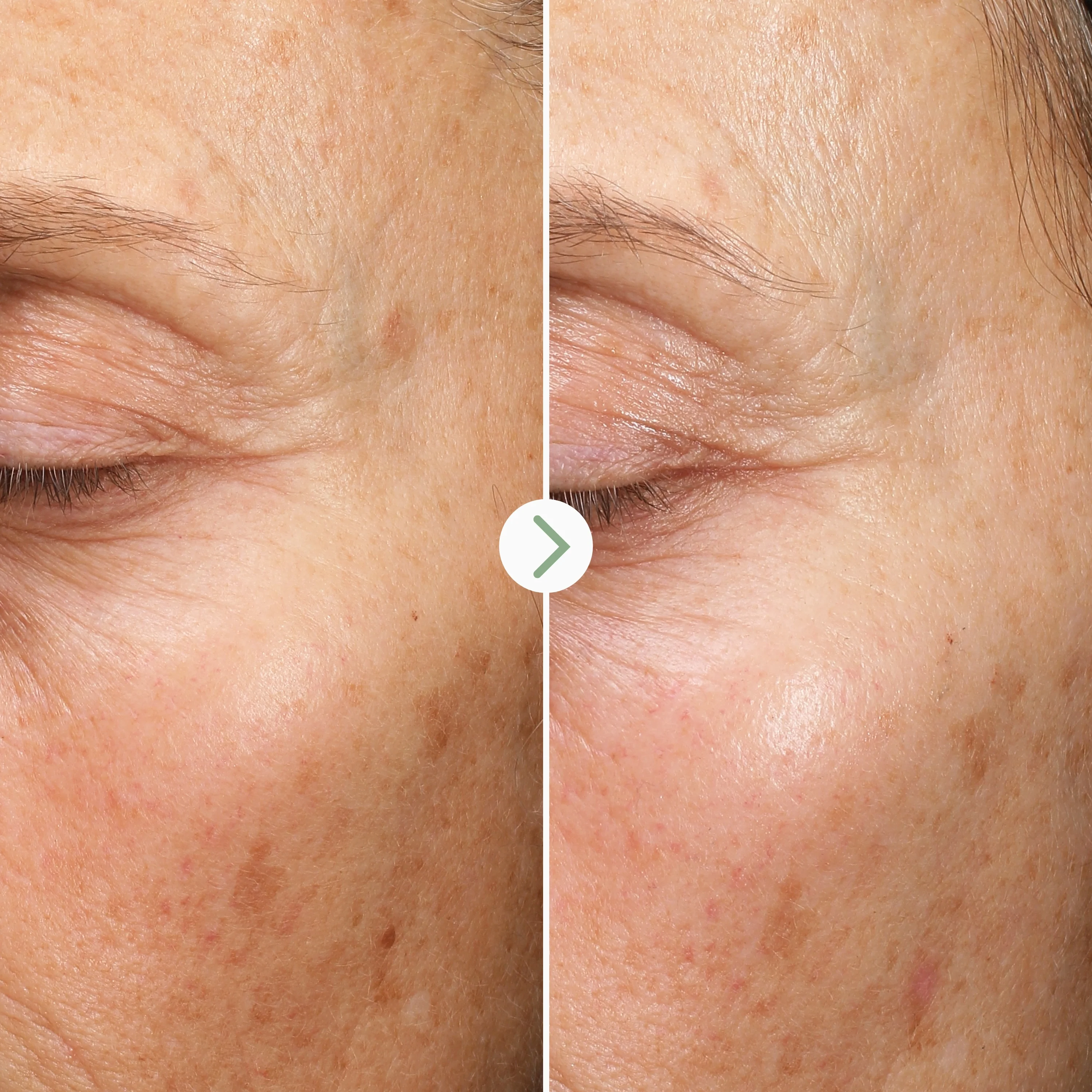 Pai Fade Forward Dark Spot Serum - Image 5
