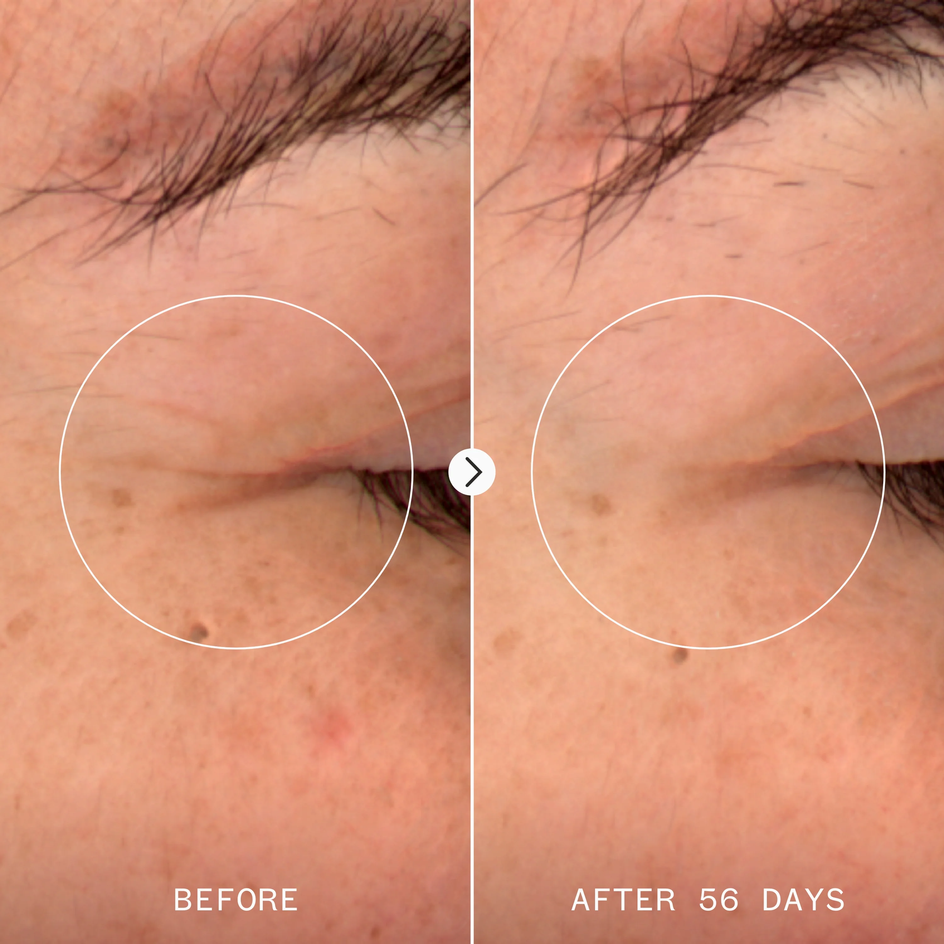 Pai NAD+ & Tri-Peptide Renewal Serum - Image 7