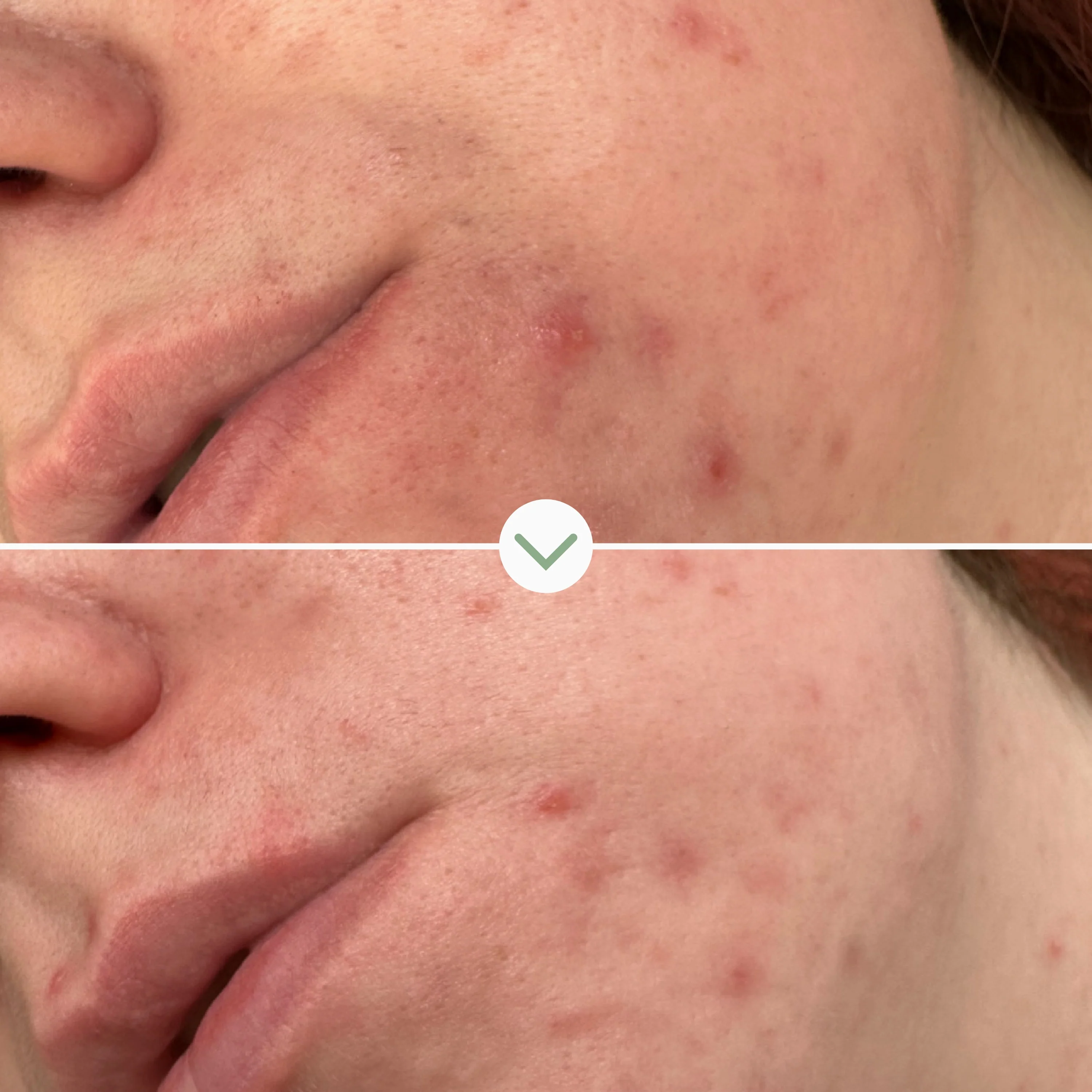 Pai Phaze™ Clarifying Face Wash - Image 5