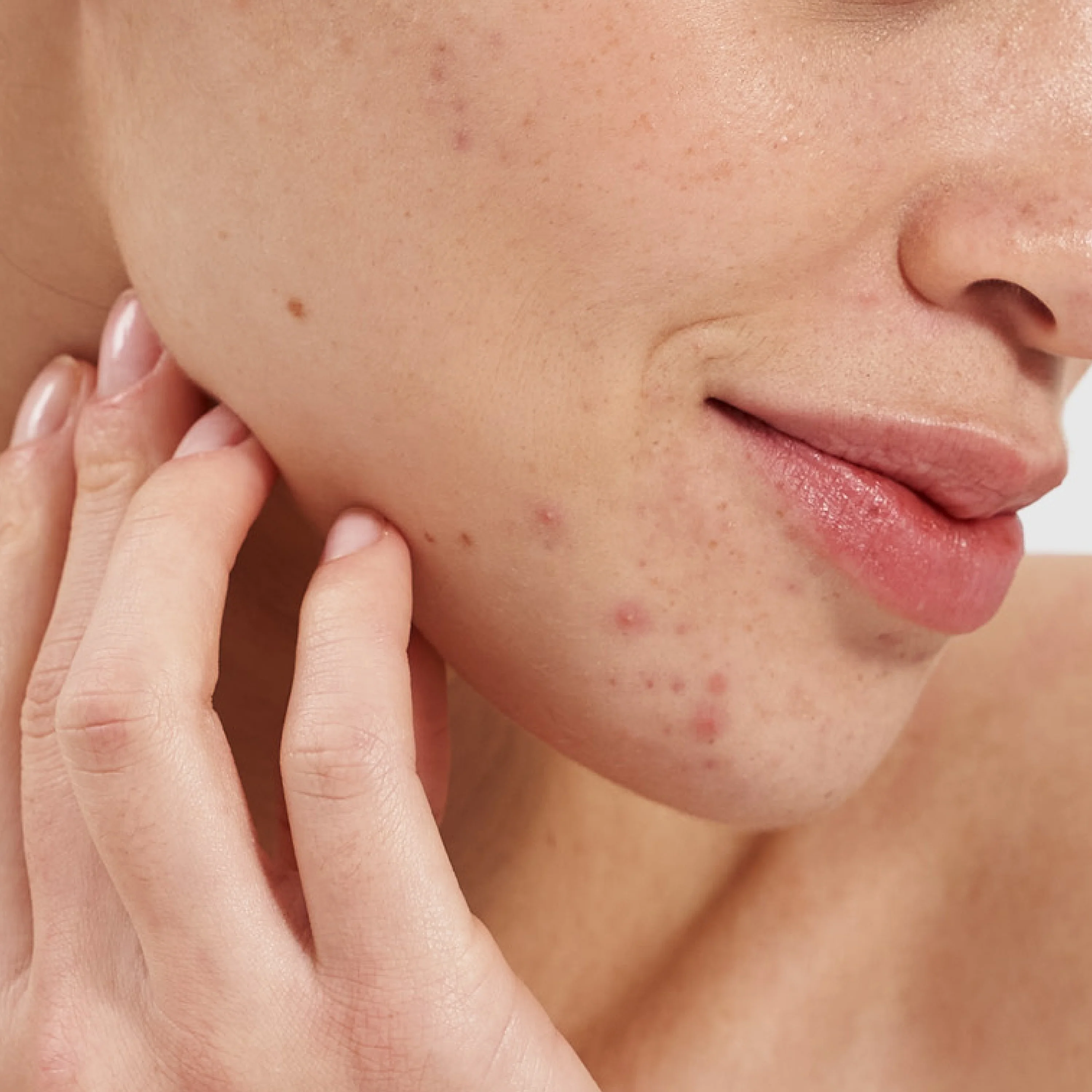 Pai Salicylic Acid 2% Clarifying Booster - Image 5