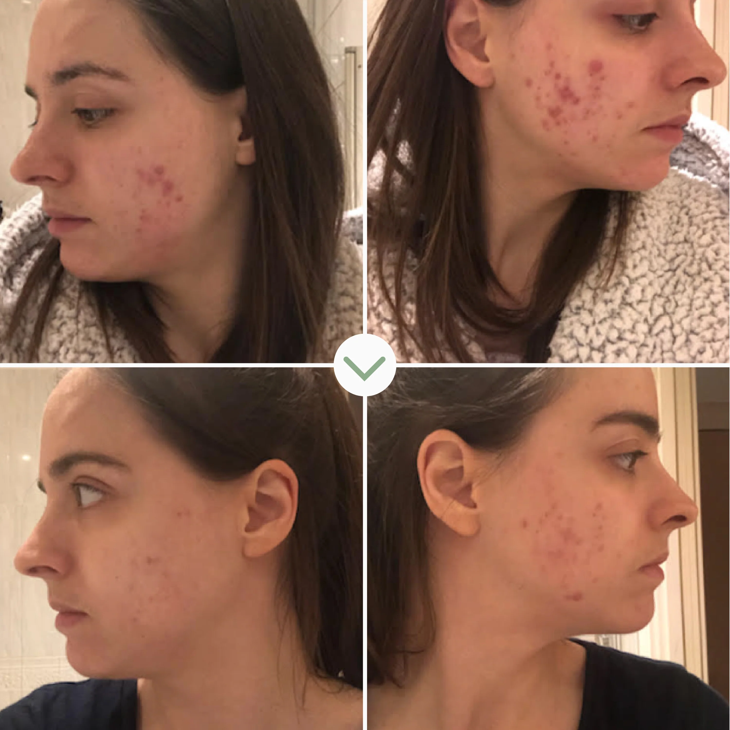 Pai Instant Kalmer™ Ceramide Serum - Image 5