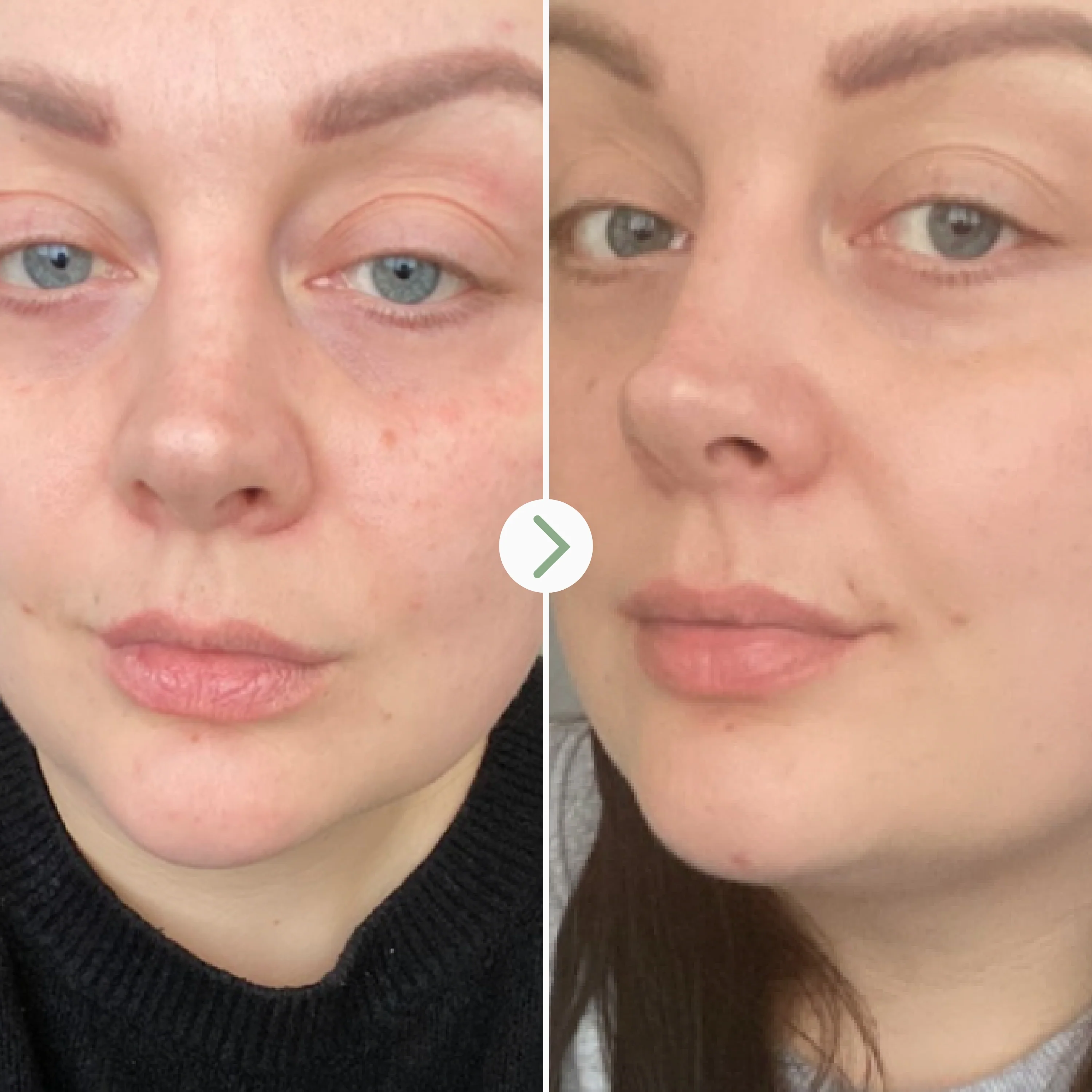 Pai Rosehip Bioregenerate™ Facial Oil - Image 5